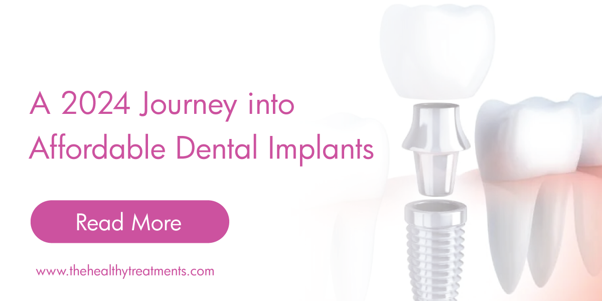 A 2024 Journey Into Affordable Dental Implants Elija Un Cirujano   2024 Dental Implants Thehealthytreatments Social 