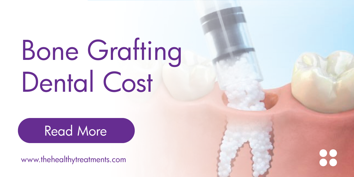 Bone Grafting Dental Cost 2024 Elija un cirujano, consulte a un